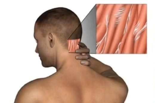 How massage guns work and whether it’s worth using?